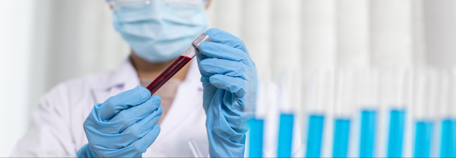 Medical employee examining blood sample